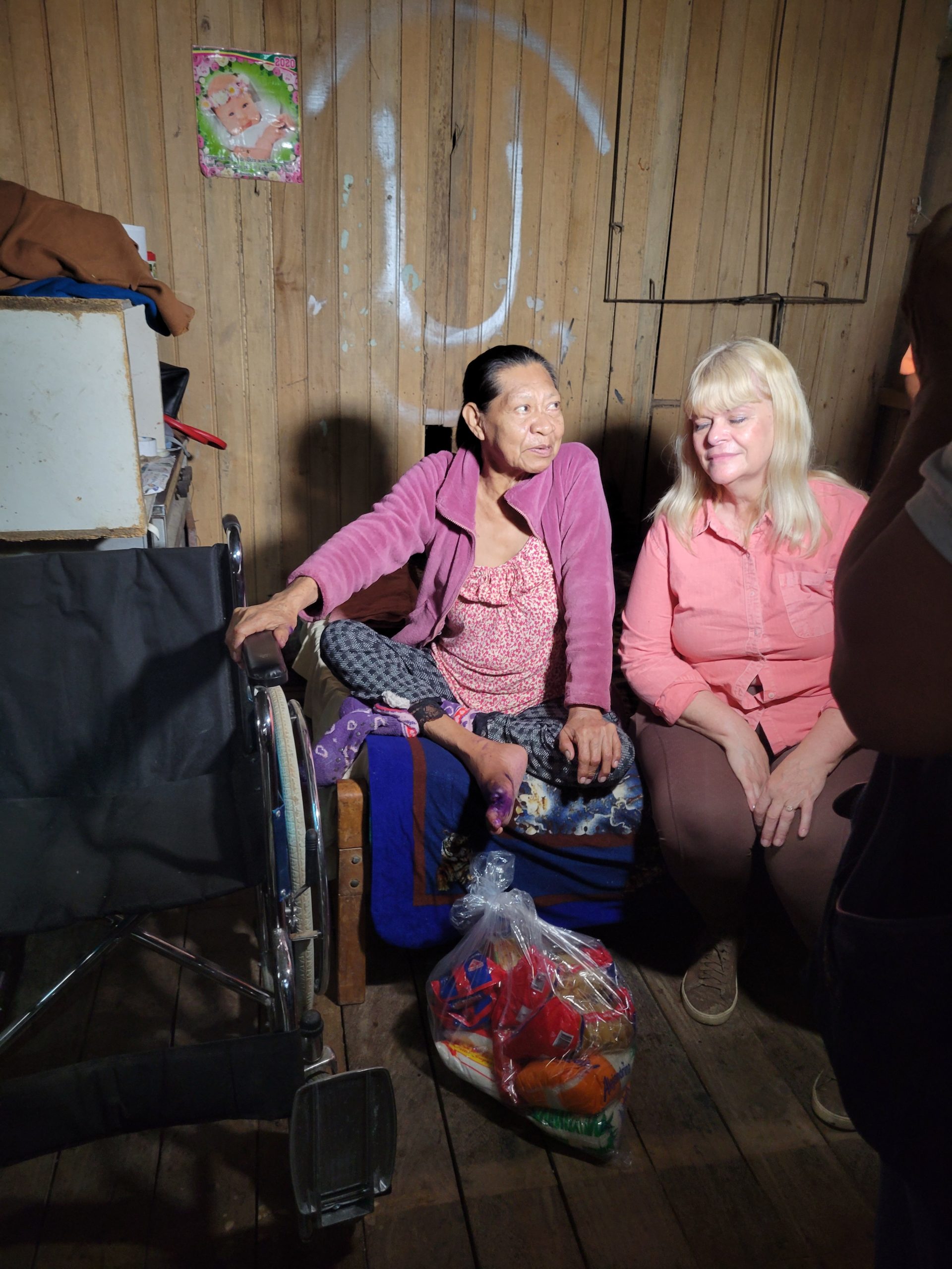 Showing and talking about her recently amputated toe.